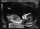12_week_scan_2.jpg